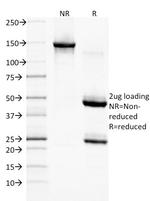 EGFR (Epidermal Growth Factor Receptor) Antibody in SDS-PAGE (SDS-PAGE)