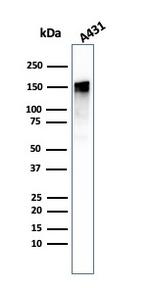 EGFR (Epidermal Growth Factor Receptor) Antibody in Western Blot (WB)