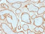 EGFRvIII (Epidermal Growth Factor Receptor, Variant III) Antibody in Immunohistochemistry (Paraffin) (IHC (P))