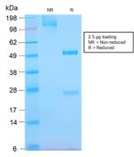 EGFR (Epidermal Growth Factor Receptor) Antibody in SDS-PAGE (SDS-PAGE)