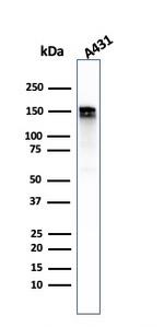 EGFR (Epidermal Growth Factor Receptor) Antibody in Western Blot (WB)