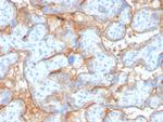 EGFR (Epidermal Growth Factor Receptor) Antibody in Immunohistochemistry (Paraffin) (IHC (P))