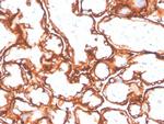 EGFR (L858R Mutant Specific) Antibody in Immunohistochemistry (Paraffin) (IHC (P))