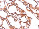 EGFR (L858R Mutant Specific) Antibody in Immunohistochemistry (Paraffin) (IHC (P))