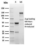 EGFR (Epidermal Growth Factor Receptor) Antibody in SDS-PAGE (SDS-PAGE)