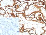 EGFR (Epidermal Growth Factor Receptor) Antibody in Immunohistochemistry (Paraffin) (IHC (P))