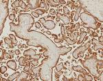 EGFR (Epidermal Growth Factor Receptor) Antibody in Immunohistochemistry (Paraffin) (IHC (P))