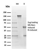 EIF2S1/EIF-2 alpha (EIF2A) Antibody in SDS-PAGE (SDS-PAGE)