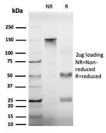 EIF4A2 (Eukaryotic Initiation Factor 4A-II) Antibody in Immunoelectrophoresis (IE)