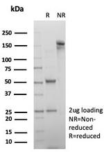 Alpha-2-Macroglobulin/A2M Antibody in SDS-PAGE (SDS-PAGE)