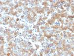 Alpha-2-Macroglobulin Antibody in Immunohistochemistry (Paraffin) (IHC (P))