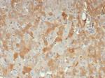 Alpha-2-Macroglobulin/A2M Antibody in Immunohistochemistry (Paraffin) (IHC (P))