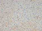 Alpha-2-Macroglobulin/A2M Antibody in Immunohistochemistry (Paraffin) (IHC (P))