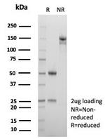 Alpha-2-Macroglobulin/A2M Antibody in SDS-PAGE (SDS-PAGE)