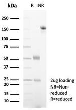 Alpha-2-Macroglobulin/A2M Antibody in SDS-PAGE (SDS-PAGE)