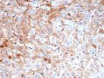 Alpha-2-Macroglobulin/A2M Antibody in Immunohistochemistry (Paraffin) (IHC (P))