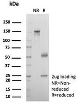 Alpha-2-Macroglobulin/A2M Antibody in SDS-PAGE (SDS-PAGE)