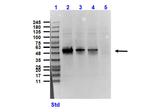 Sucrose Phosphorylase Antibody in Western Blot (WB)