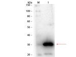 Carbonic Anhydrase I Antibody in Western Blot (WB)