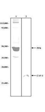 Fructose-6-Phosphate Kinase Antibody in Western Blot (WB)