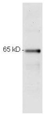 NFkB p65 Antibody in Western Blot (WB)