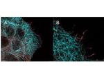 Phospho-AKT (Ser473) Antibody in Immunocytochemistry (ICC/IF)