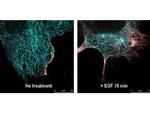 Phospho-AKT (Ser473) Antibody in Immunocytochemistry (ICC/IF)