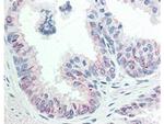 Phospho-AKT (Ser473) Antibody in Immunohistochemistry (Paraffin) (IHC (P))