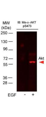 Phospho-AKT (Ser473) Antibody in Western Blot (WB)