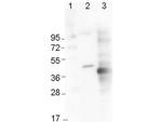 6X His Epitope Tag Antibody in Western Blot (WB)