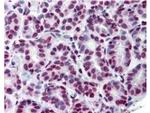 Phospho-Stat5 (Tyr694) Antibody in Immunohistochemistry (Paraffin) (IHC (P))