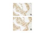 AKT3 Antibody in Immunohistochemistry (Paraffin) (IHC (P))