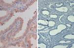 Phospho-AKT (Ser473) Antibody in Immunohistochemistry (Paraffin) (IHC (P))