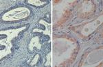 Phospho-AKT (Thr308) Antibody in Immunohistochemistry (Paraffin) (IHC (P))