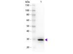 Carbonic Anhydrase II Antibody in Western Blot (WB)