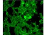 beta-2-Microglobulin Antibody in Immunocytochemistry (ICC/IF)