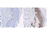 beta-2-Microglobulin Antibody in Immunohistochemistry (Paraffin) (IHC (P))