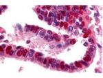 Ubiquitin Activating Enzyme E1 Antibody in Immunohistochemistry (Paraffin) (IHC (P))