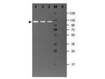 beta Galactosidase Antibody in Western Blot (WB)