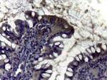 Carbonic Anhydrase II Antibody in Immunohistochemistry (IHC)