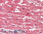 Aha1 Antibody in Immunohistochemistry (Paraffin) (IHC (P))