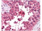 Aha1 Antibody in Immunohistochemistry (Paraffin) (IHC (P))