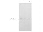 Thymidylate Synthase Antibody in Western Blot (WB)