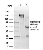 ELK1 Antibody in SDS-PAGE (SDS-PAGE)