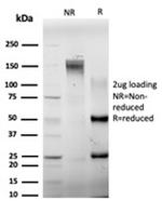 ELK1 Antibody in SDS-PAGE (SDS-PAGE)