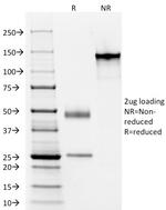 Elastin (ELN) Antibody in SDS-PAGE (SDS-PAGE)