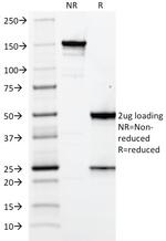 Elastin (ELN) Antibody in SDS-PAGE (SDS-PAGE)