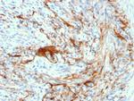 Elastin (ELN) Antibody in Immunohistochemistry (Paraffin) (IHC (P))