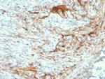 Elastin (ELN) Antibody in Immunohistochemistry (Paraffin) (IHC (P))