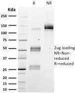 Emerin Antibody in SDS-PAGE (SDS-PAGE)